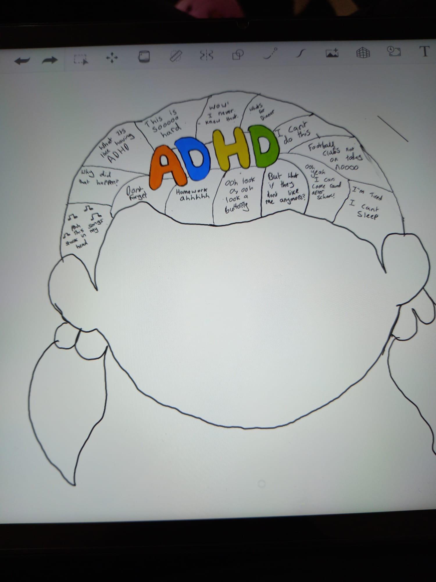 ADHD 2